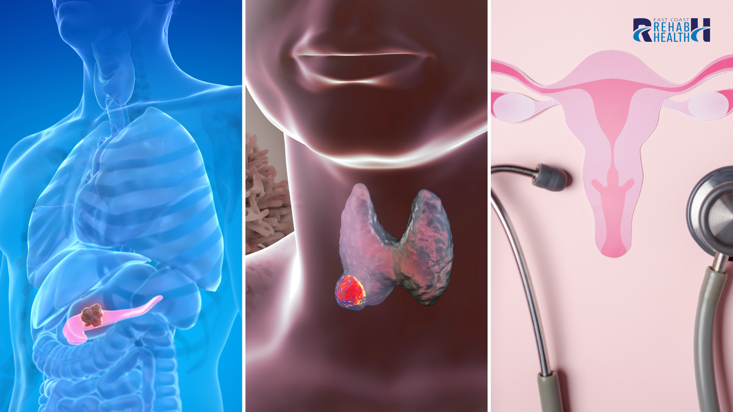🌿 Movement as Medicine: Why This Campaign on Metabolic & Endocrine Disorders Matters